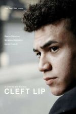 Watch Cleft Lip Myflixer