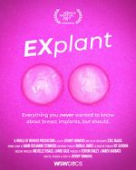 Watch Explant Myflixer