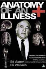 Watch Anatomy of an Illness Myflixer