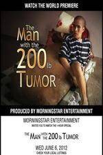 Watch The Man With The 200lb Tumor Myflixer