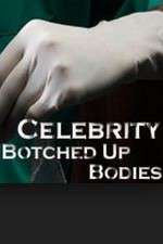 Watch Celebrity Botched Up Bodies Myflixer